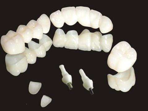 MIM注射成型陶瓷（cí）牙（yá）